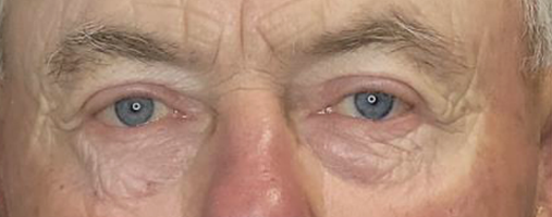 Case 01, after